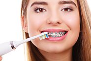 How to Brush Teeth with Braces: A Simple Guide