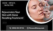 Get Advanced Nano Needling Treatment with Our Experts!