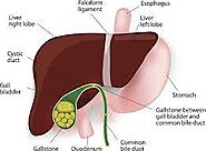 Navigating Hope: Discover Advanced Rectal Cancer Surgery Solutions at Crest Practice