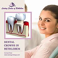 Dental Crowns in Bethlehem | Restore Your Smile with Dentist Bethlehem