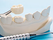 Everything You Need to Know About Same-Day Crowns - Smile Every Day Dentistry