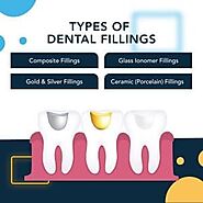 Are Fillings Permanent? Understanding Tooth Restoration - Smile Every Day Dentistry