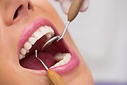The Benefits of Professional Teeth Whitening in Leichhardt: A Complete Guide – Dr. Nidhi Berera