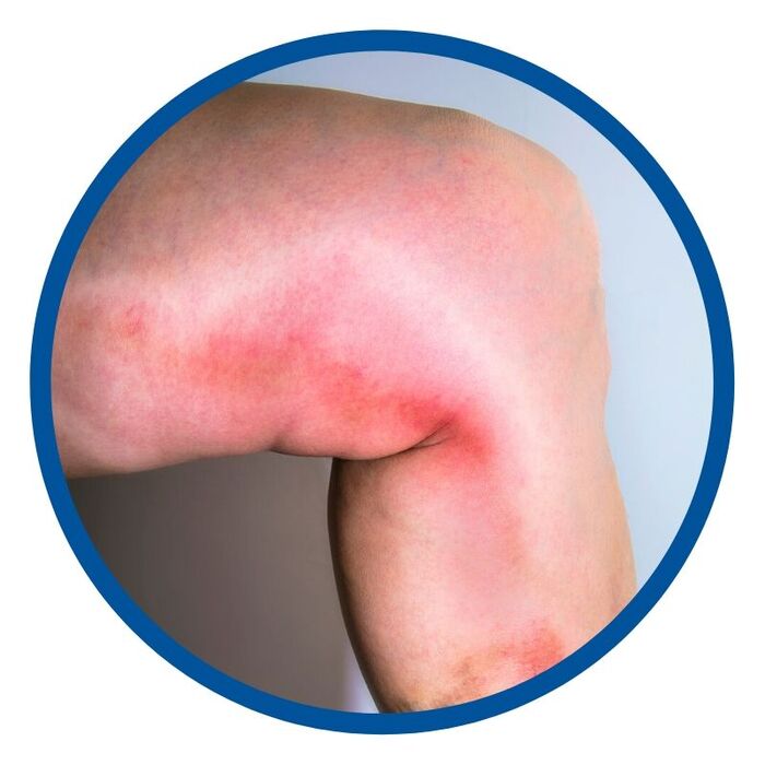 USA Vein Clinics A Listly List