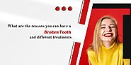 Website at https://www.francewow.com/what-are-the-reasons-you-can-have-a-broken-tooth-and-different-treatments