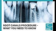Understanding the Root Canal Process