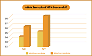 Is Hair Transplant 100% Successful?