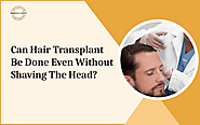 Can Hair Transplant Be Done Even Without Shaving the Head