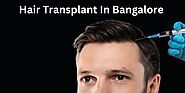 Hair Transplant In Bangalore