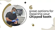 6 Great options for repairing your chipped tooth - Talkfellas