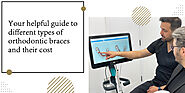 Helpful Guide to Different Types of Orthodontic Braces and Their Cost - The Blog Bridge