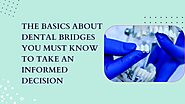 The basics about dental bridges that you must know to take an informed decision