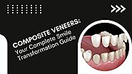 Composite Veneers: Your Complete Smile Transformation Guide