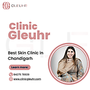 Best Skin Clinic in Chandigarh - Clinic Gleuhr