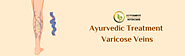 Ayurvedic Treatment For Varicose Veins - Divyamrut Ayurcare