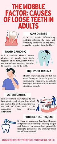 The Wobble Factor: Causes of Loose Teeth in Adults | by Emergency Dentist London Pro | May, 2024 | Medium