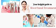 Your helpful guide to root canal treatment