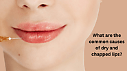 What are the common causes of dry and chapped lips ?