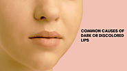 Common causes of dark or discolored lips?