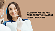Common Myths and Misconceptions About Dental Implants