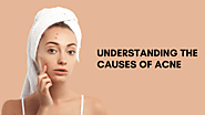 understanding the cause of acne