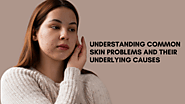 Understanding Common Skin Problems and Their Underlying Causes