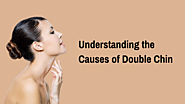 Understanding the Causes of Double Chin