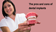 The pros and cons of dental implants