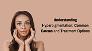 Understanding Hyperpigmentation: Common Causes and Treatment Options