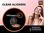 Best Clinic for Teeth Aligners in Kukatpally, Hyderabad, FMS Dental Hospital