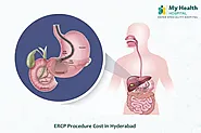 ERCP Procedure Cost in Hyderabad - Lowest Price - My Health Hospitals