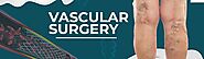 Finding the Best Vascular Surgeon: 5 Essential Factors to Consider