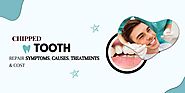 Chipped Tooth Repair: Symptoms, Causes, Treatments & Cost