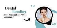 Dental Bonding: What to Expect From this Affordable Tooth Restoration Option - Binbex
