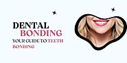 Dental Bonding: Your Guide to Teeth Bonding - IQOS TEREA Dubai UAE