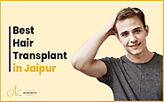Best Hair Transplant Techniques Available in Jaipur
