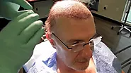[Reveal!] The Survival Rates of NeoGraft Hair Transplantation - Hairhealthtips.com