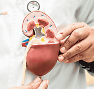 Ayurvedic Elegance: Crafting Kidney Health with Expert Precision