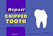 Chipped Tooth Problems Solved with These Simple Methods
