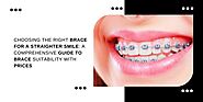 Choosing the Right Brace for a Straighter Smile: A Comprehensive Guide to Brace Suitability with Prices