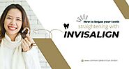 How to began your teeth straightening with Invisalign