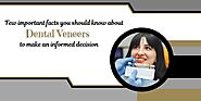 Website at https://journalbloggers.com/few-important-facts-you-should-know-about-dental-veneers-to-make-an-informed-d...