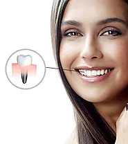 Single Tooth Dental Implant in India, FMS Dental Hospital Hyderabad