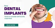 Few dental implants facts to consider before the treatment