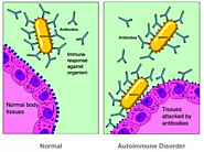 PANS & PANDAS Syndrome: Symptoms, Diagnosis & Treatment | BNC