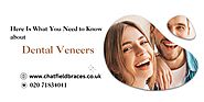 Here Is What You Need to Know about Dental Veneers