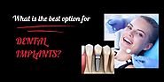 What is the best option for dental implants?