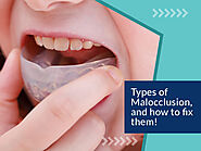 Different Types of Malocclusion and Fix Crooked Teeth