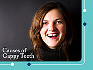 Gappy Teeth – Causes, Treatment & Prevention – Chatfield Braces