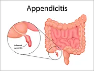 Appendix Surgery Hospital In Nerul - Dr Deshpande's Hospital